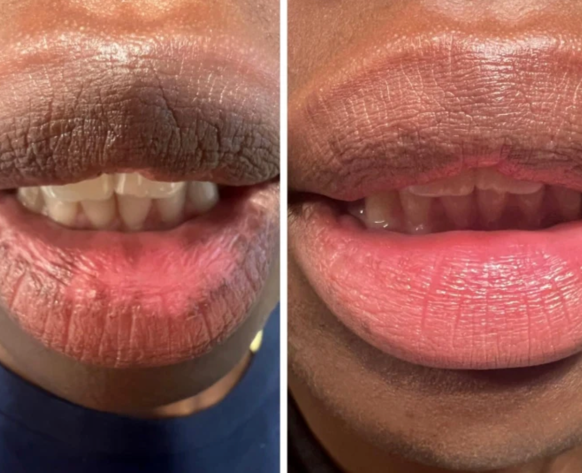 Nuvira™ Dark Lips Brightening Cream