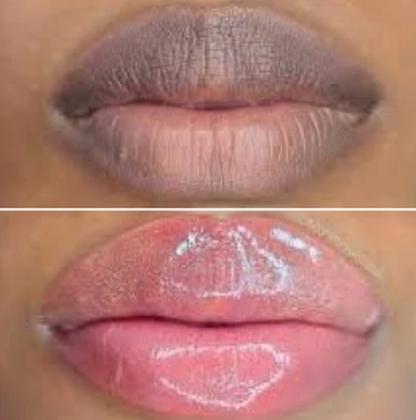 Nuvira™ Dark Lips Brightening Cream