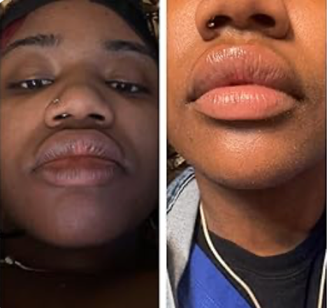 Nuvira™ Dark Lips Brightening Cream