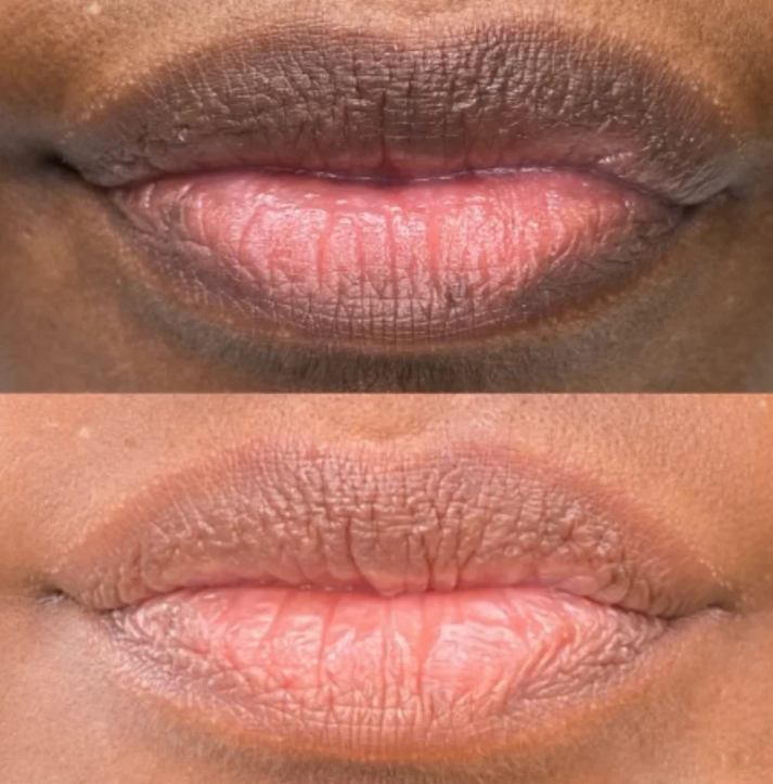 Nuvira™ Dark Lips Brightening Cream